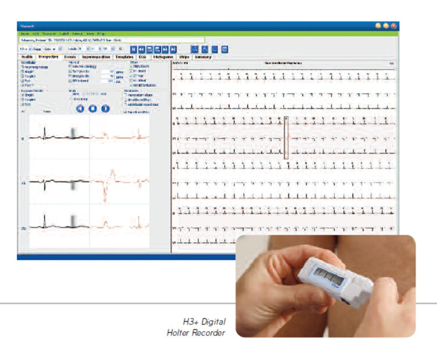 Vision Express Holter Analysis System Software w/ One 48 Hr H3+ Holter