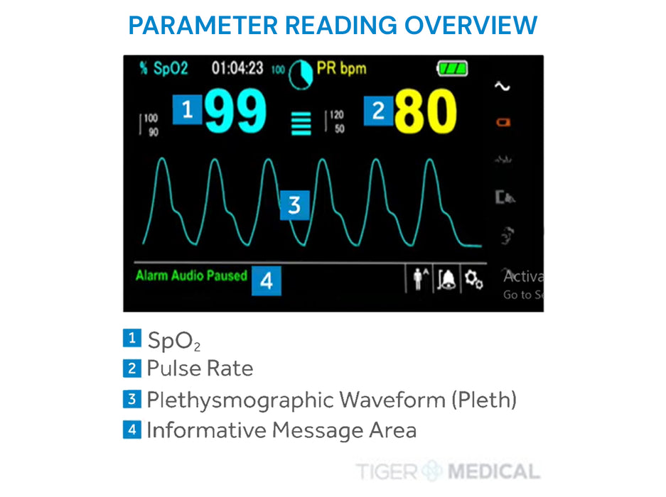 Nellcor Bedside SpO2 Patient Monitoring System