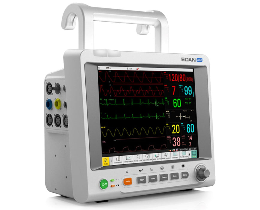 iM60 10.4" Vital Signs Patient Monitor with G2 O2, Touch Screen, Wi-Fi and Printer