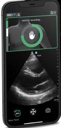Ultrasound Equipment