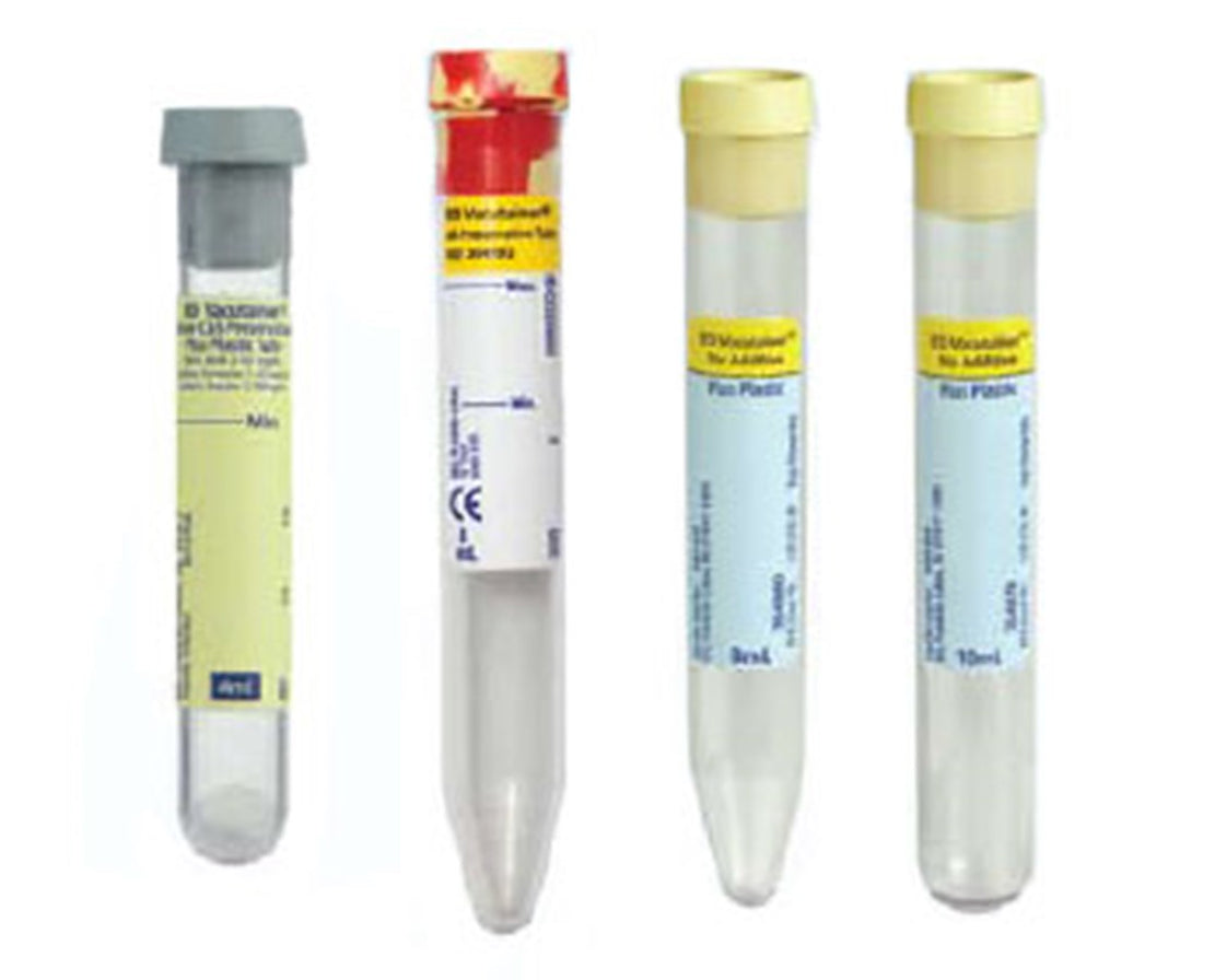 BD Vacutainer Urinalysis Tubes. Save at Tigermedical — Tiger Medical