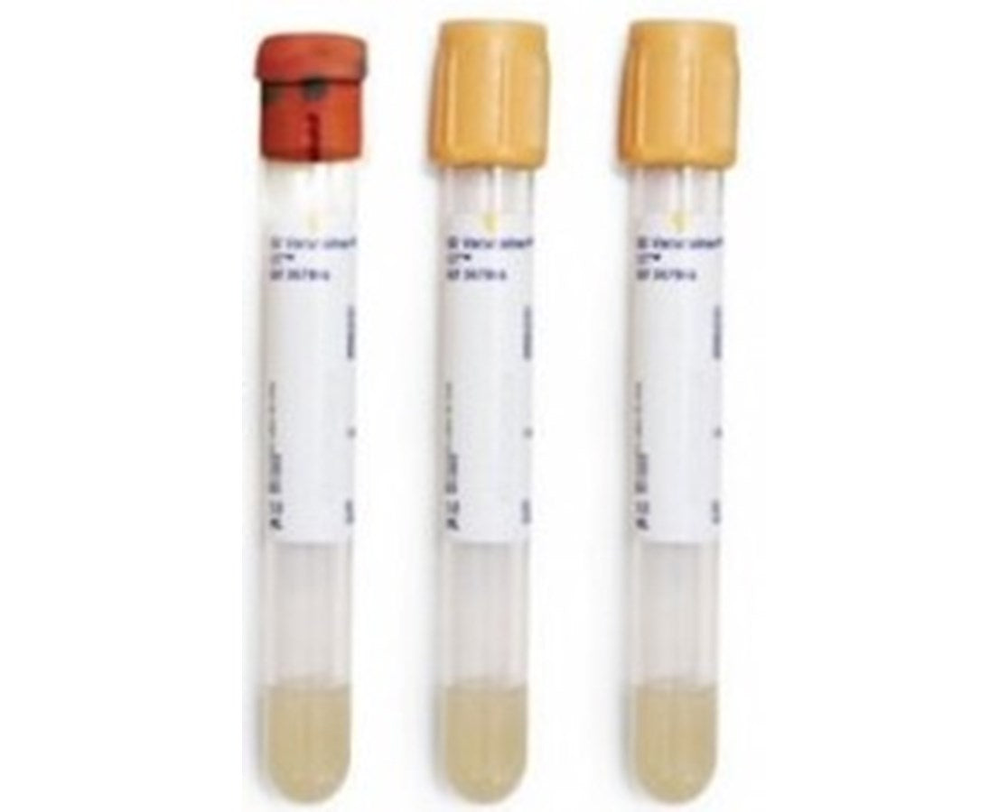 What Color Is Sst Tube