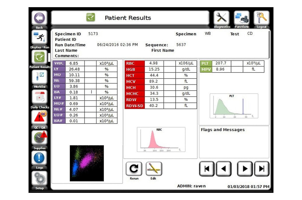 DxH 560 Hematology Analyzer