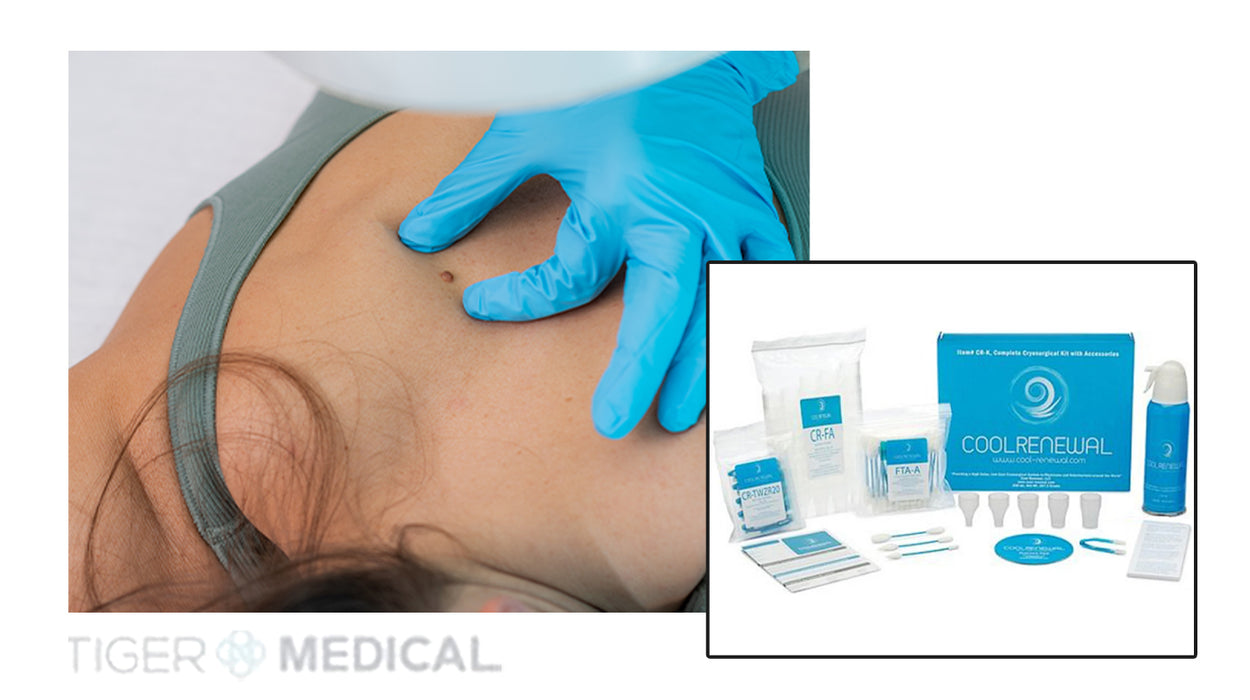 Cryosurgery Freeze Kit - 170mL Canisters