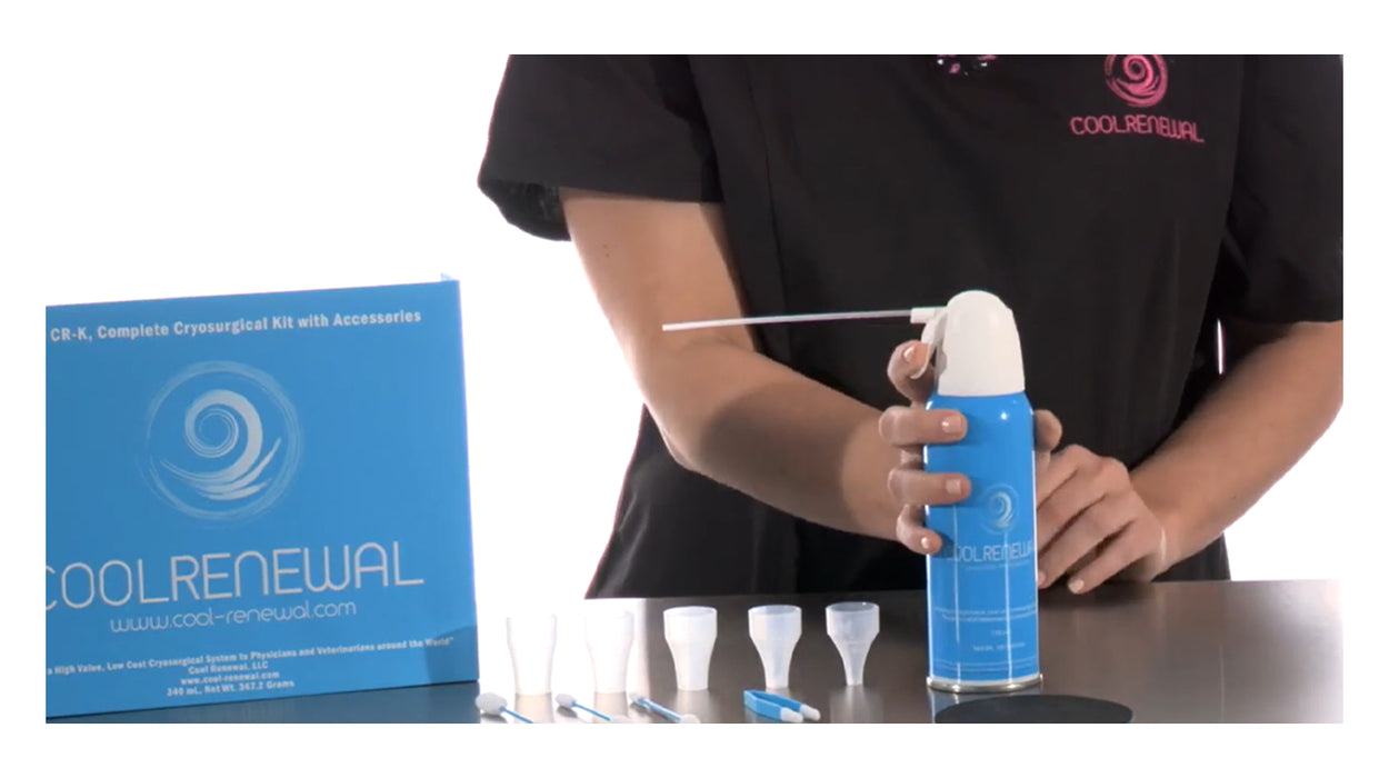 Cryosurgery Freeze Kit - 170mL Canisters