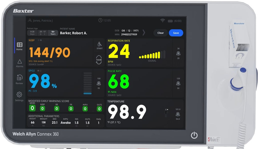 Welch Allyn Connex 360 Vital Signs Monitor. Save at Tigermedical