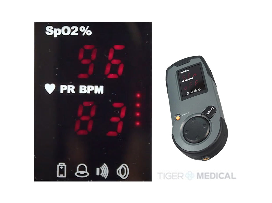 Hand-Held Pulse Oximeter Monitor