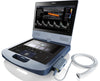 Acclarix AX4 Ultrasound