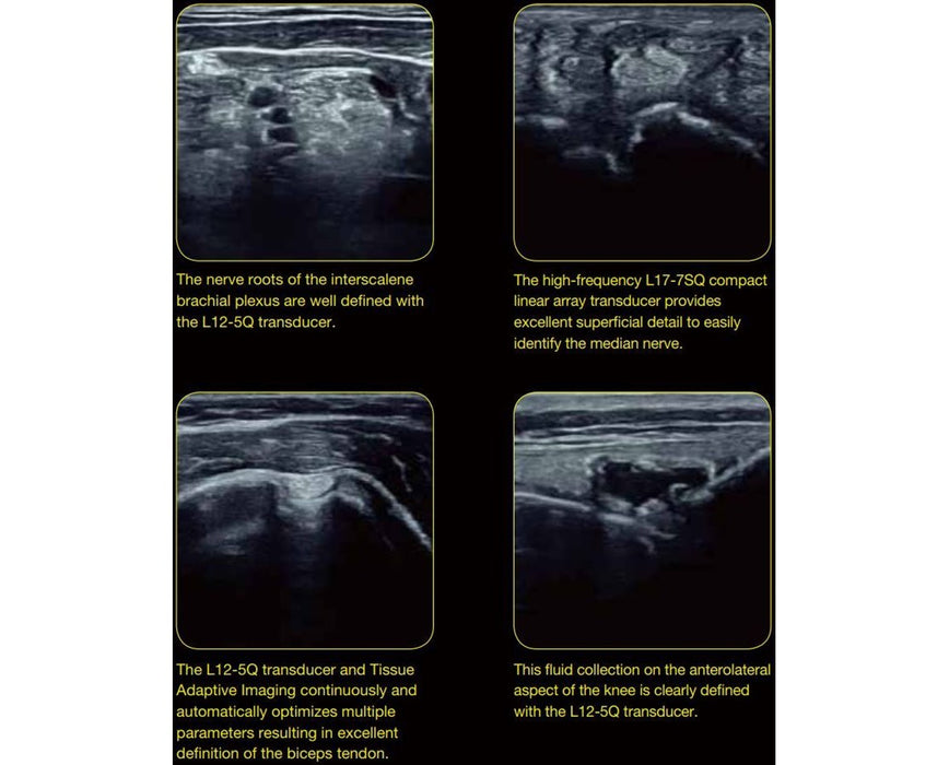 Acclarix AX4 Ultrasound
