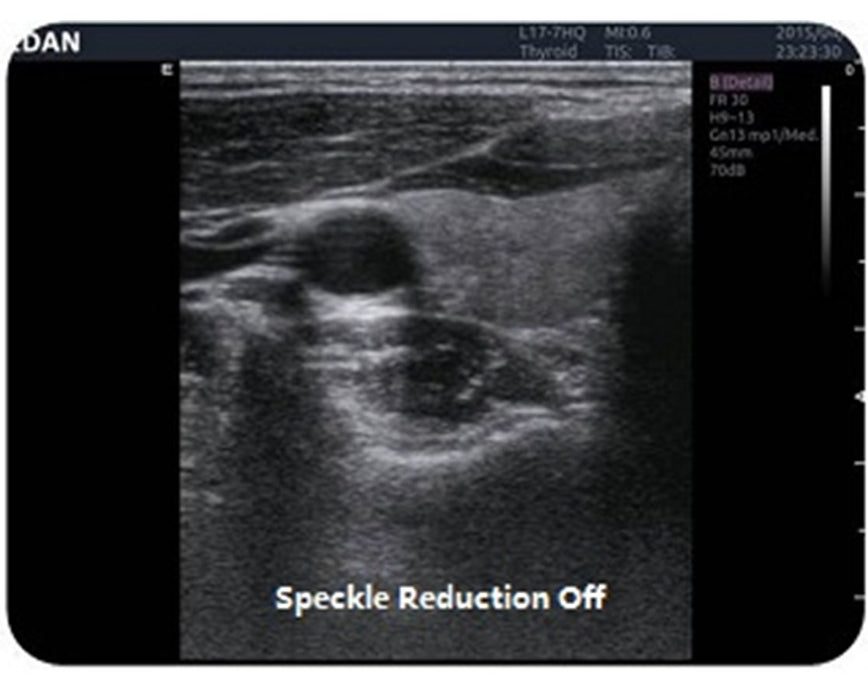 Acclarix AX4 Ultrasound