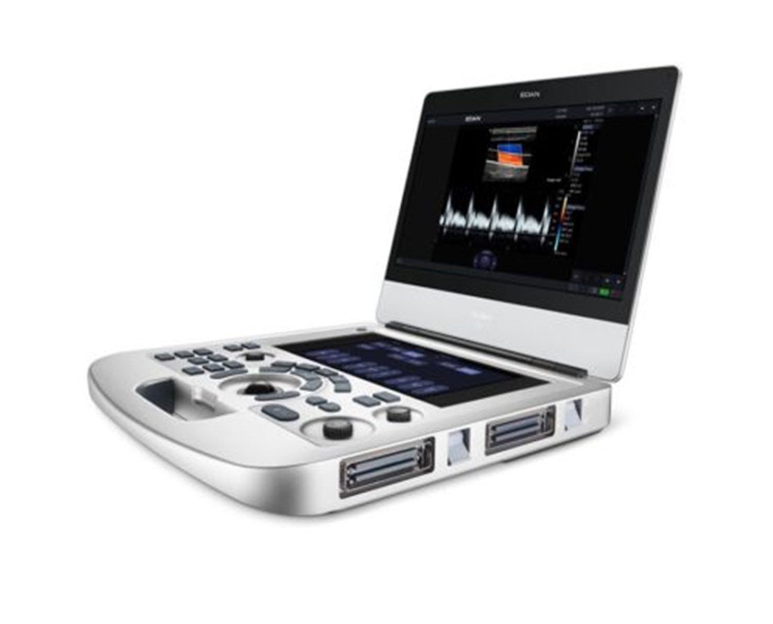 Edan Acclarix AX3 Compact Ultrasound. Save at Tigermedical — Tiger