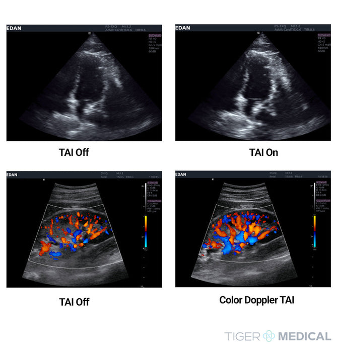 Acclarix AX8 Diagnostic Ultrasound