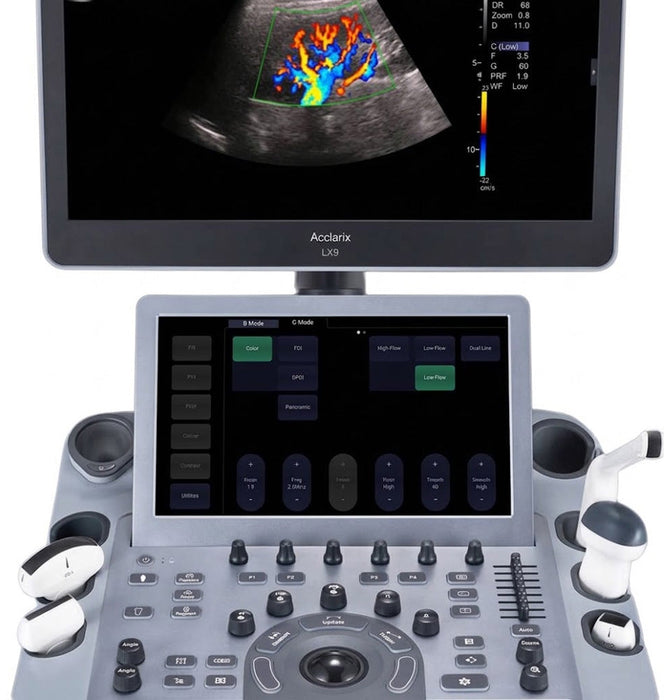 Acclarix LX9 Diagnostic Ultrasound