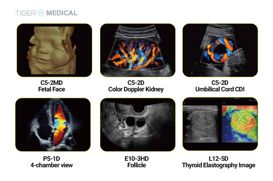 Acclarix LX9 Diagnostic Ultrasound
