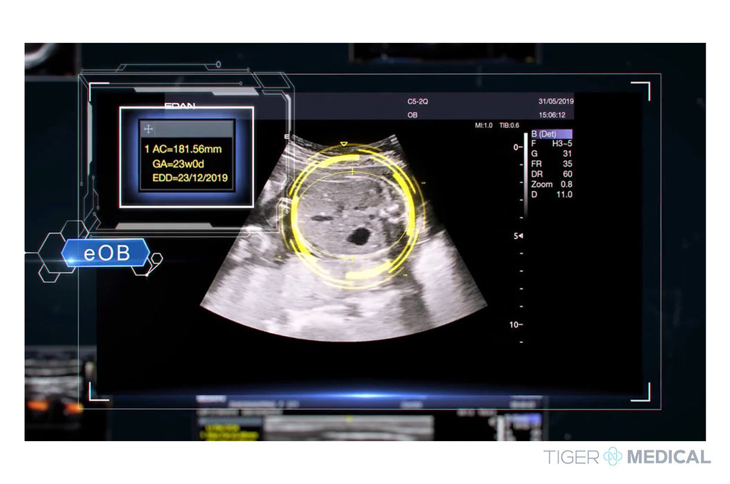 Acclarix LX9 Diagnostic Ultrasound
