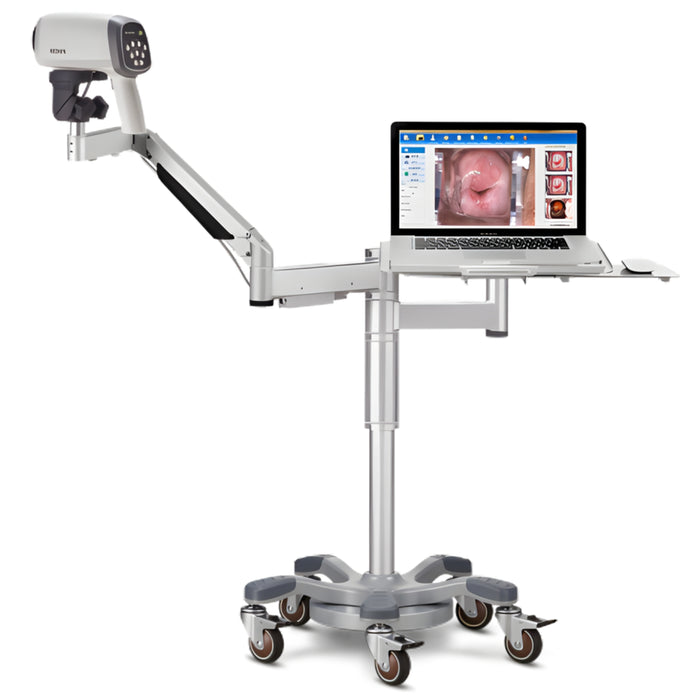 HD Video Colposcope w/ Swing Arm Stand & PC Tray