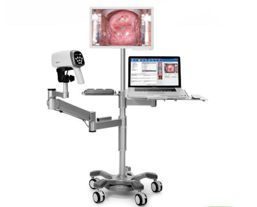 C6AHD HD Video Colposcope w/ Stand