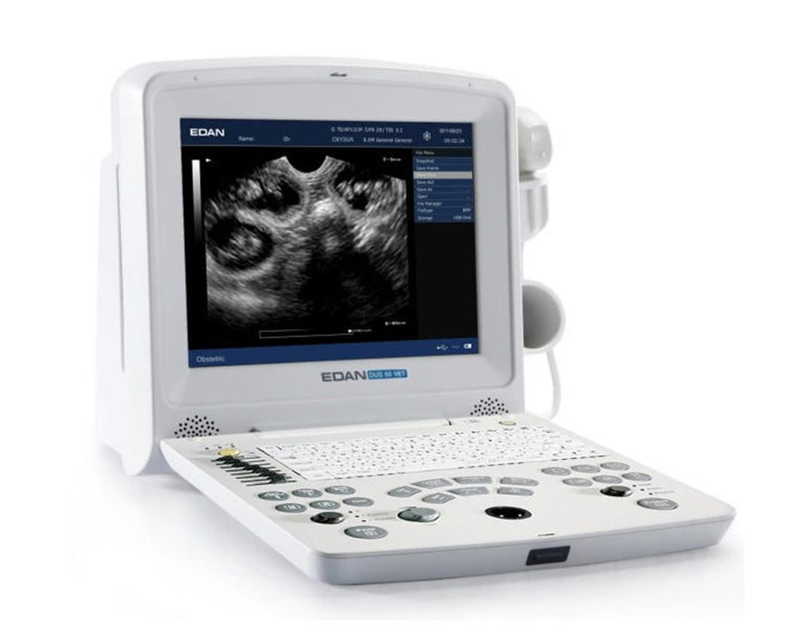 DUS60 Digital Ultrasonic Diagnostic Imaging System