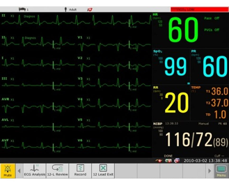 Elite V5, V6, V8 Modular Patient Monitor