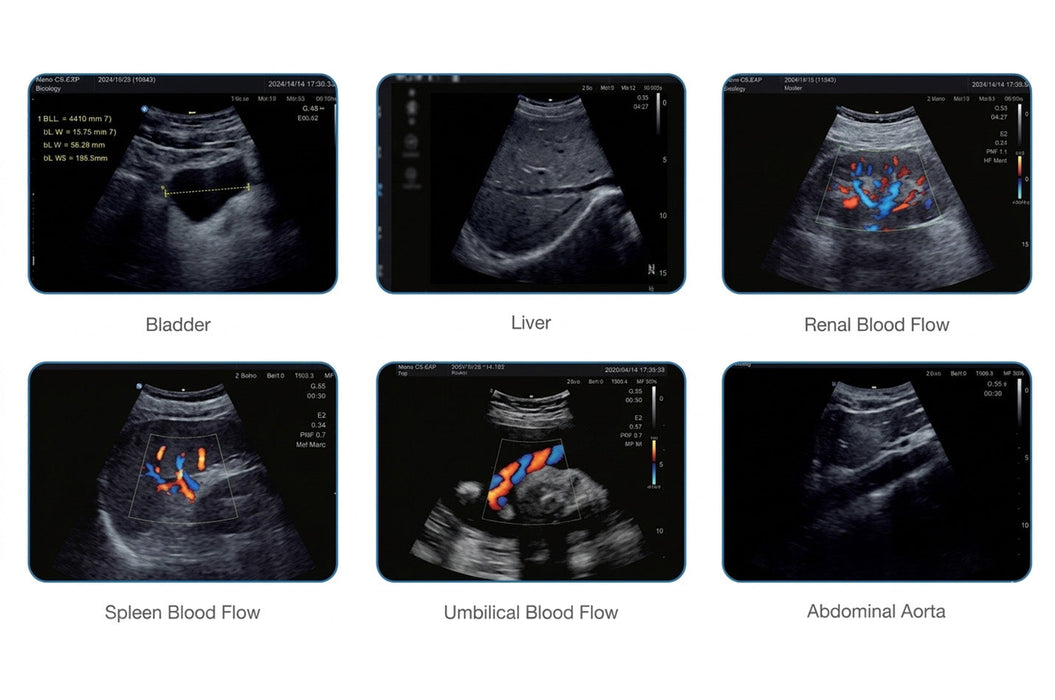 Nano C5 EXP Convex Ultrasound Probe