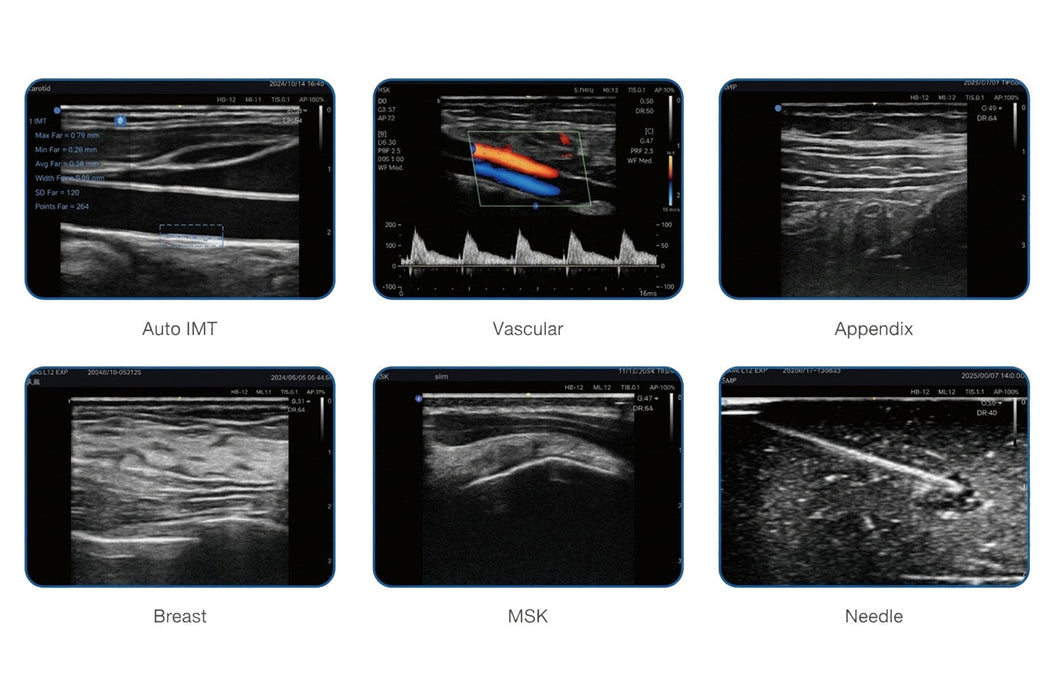 Nano EXP Portable Ultrasound Scanner