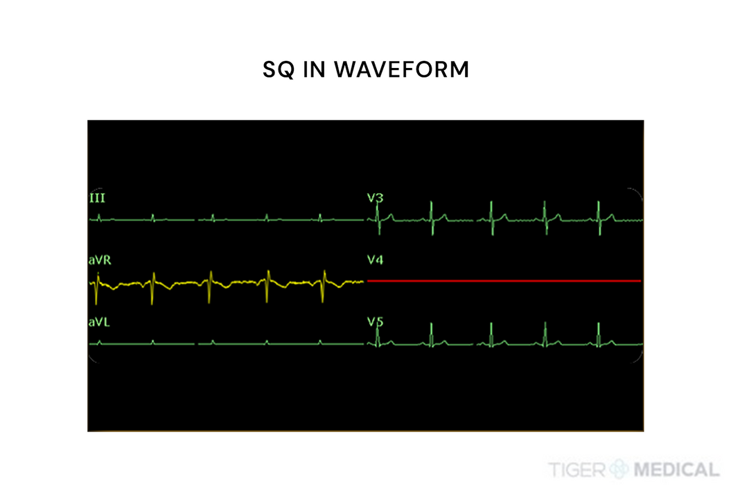 SE-1515 PC Based Wired ECG Sampling Box