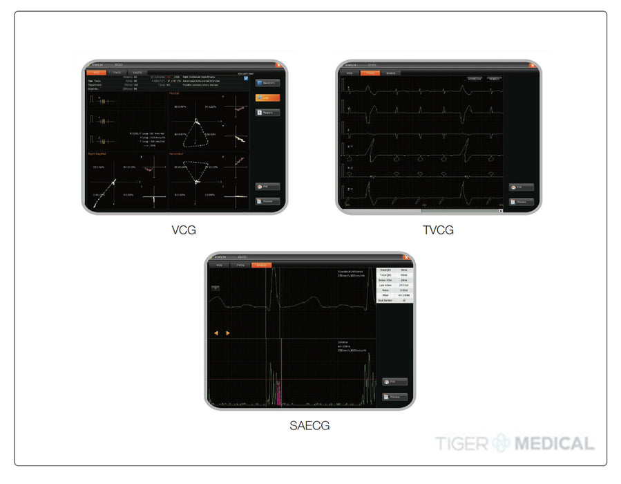 SE-18 Resting ECG System