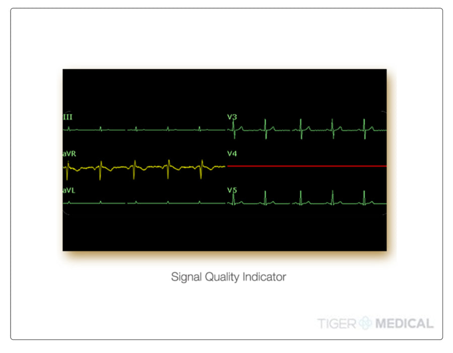 SE-301 3-Channel Resting ECG System