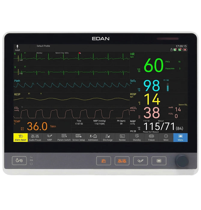 13" Vital Signs Patient Monitor w/ CO2 & Printer