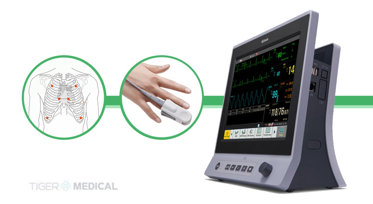 X Patient Monitor