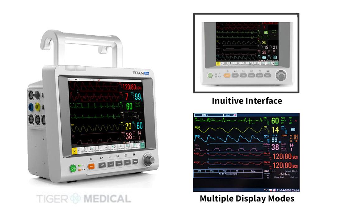 iM60 10.4" Vital Signs Patient Monitor