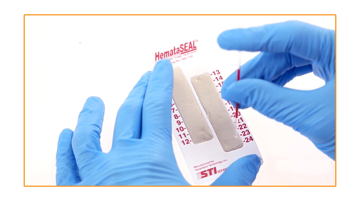 HemataStat II Hematocrit Blood Analyzer Centrifuge