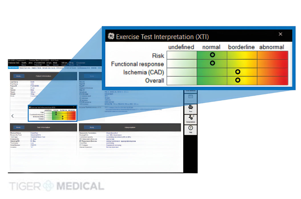 CardioSoft V7 ECG Cardiac Test System