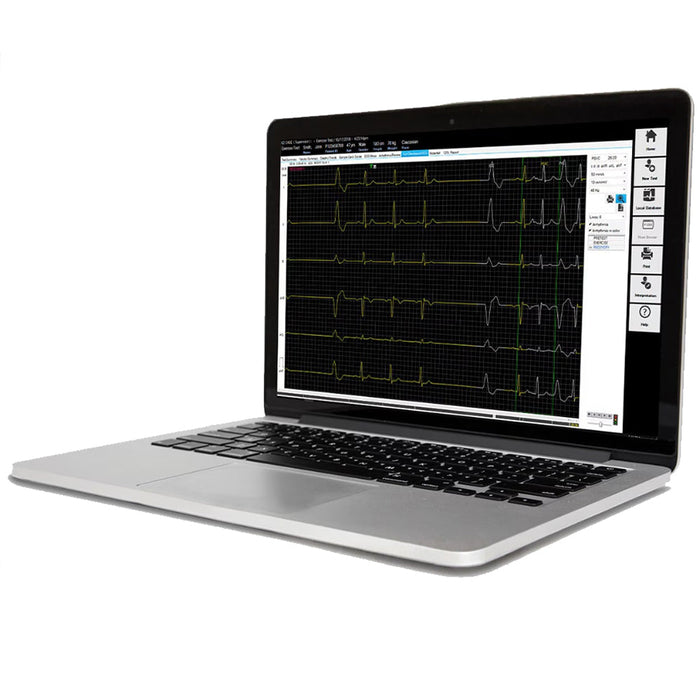 CardioSoft V7 ECG Cardiac Resting & Stress Test System. TTL, 12SL & Risk Algorithms