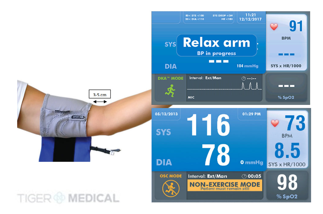 Tango M2 Stress Test NIBP Monitor