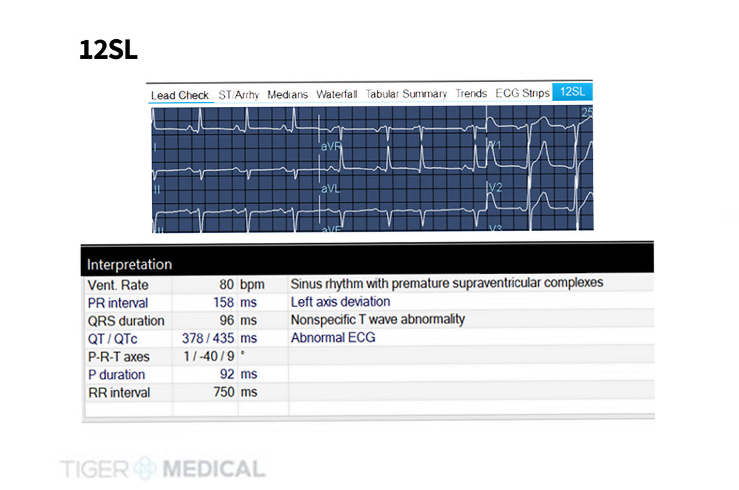 CASE V7 Cardiac Stress Test System