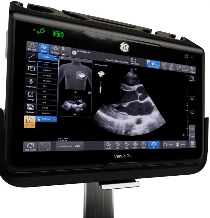 Venue Go R5 Ultrasound System