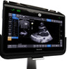 Venue Go R5 Ultrasound System