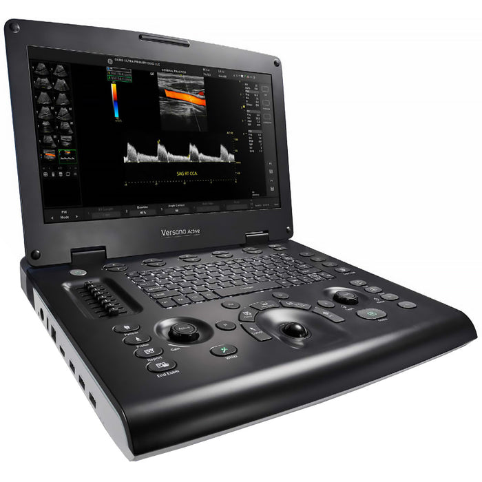 Versana Active Ultrasound