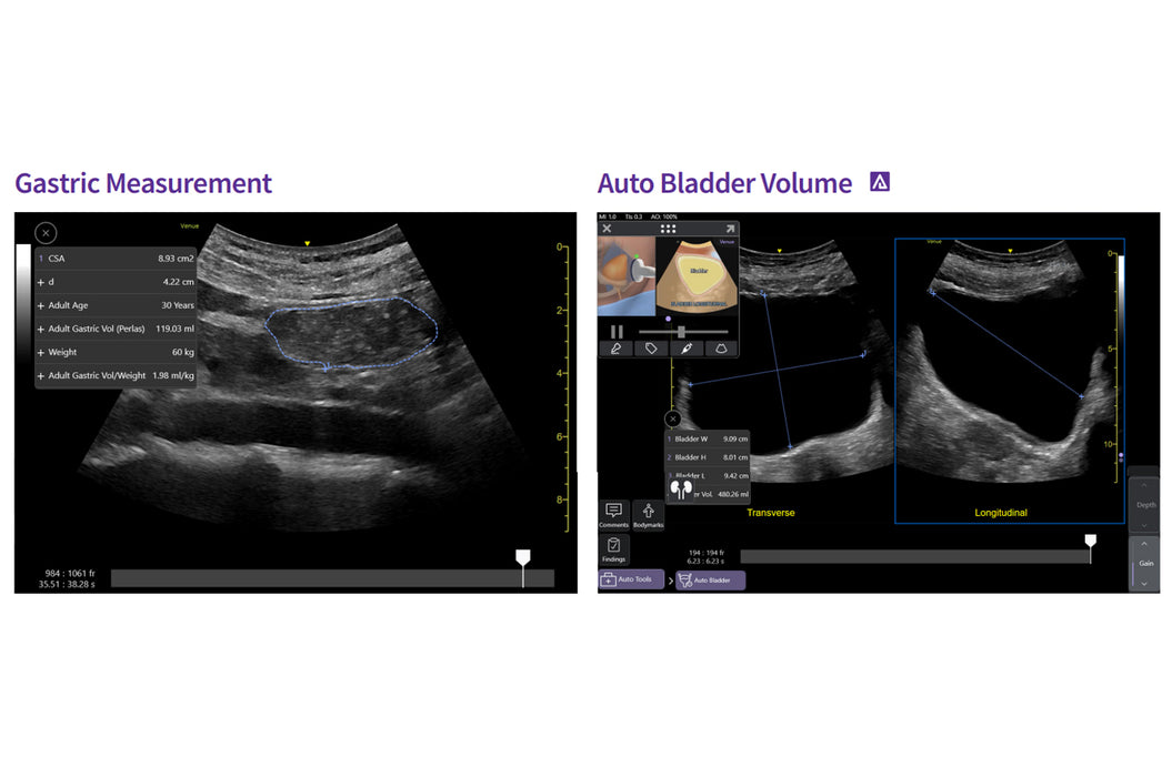Venue Sprint Ultrasound
