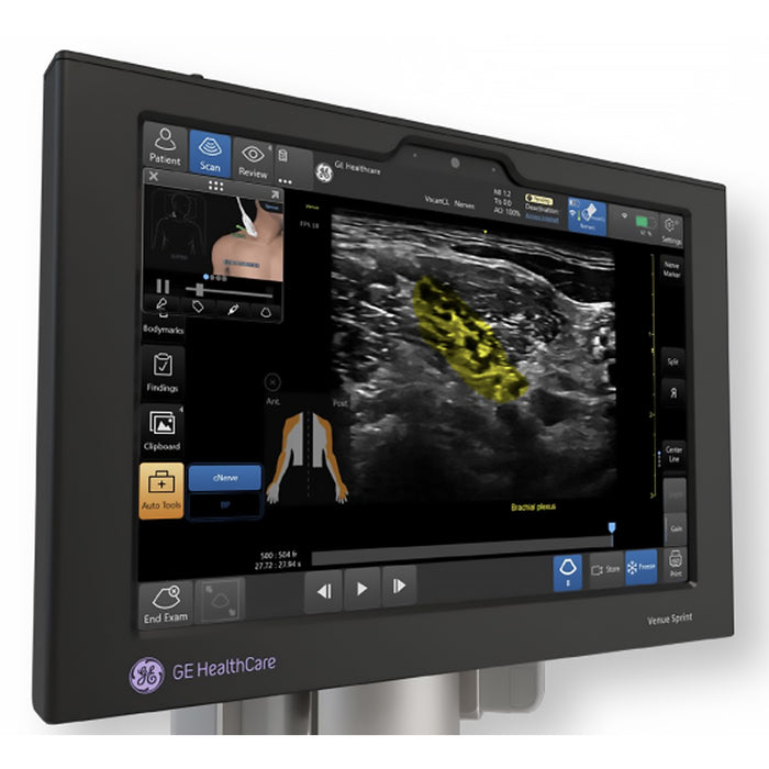 Venue Sprint Ultrasound