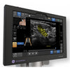 Venue Sprint Ultrasound