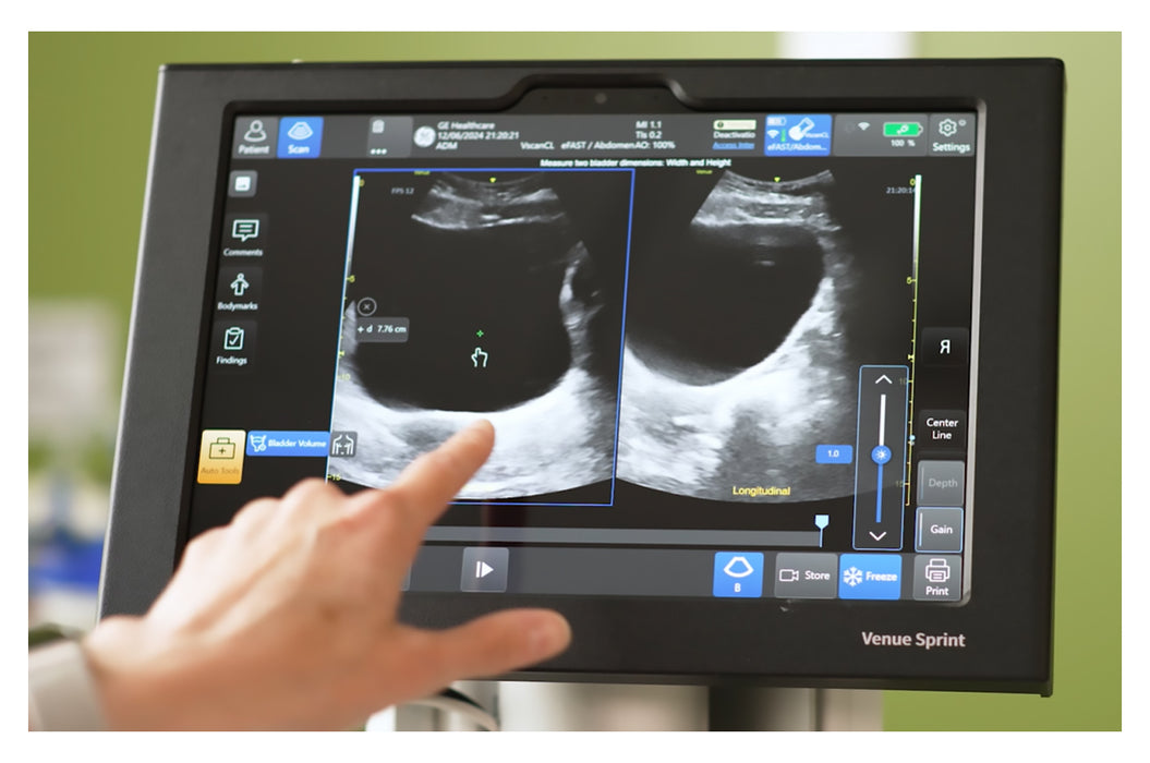 Venue Sprint Ultrasound