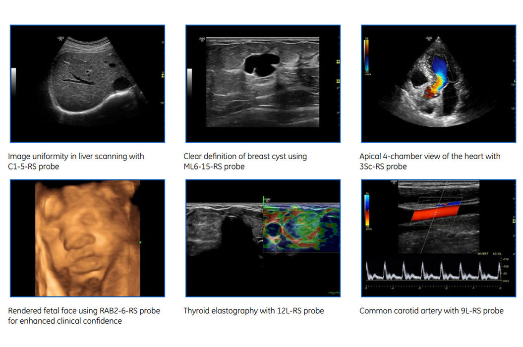Logiq P9 Xdclear Ultrasound