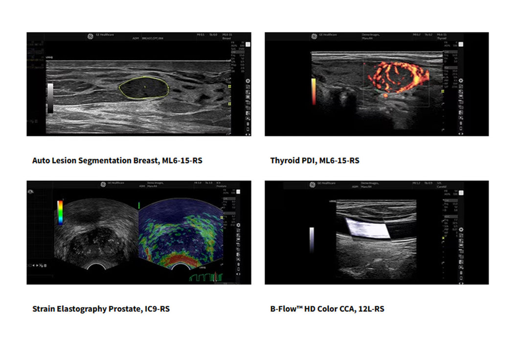 Logiq P10 Xdclear Ultrasound