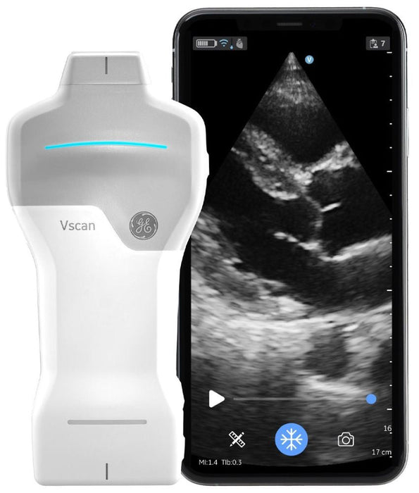 Vscan Air SL Sector Handheld Ultrasound Scanner. Phased Array & Linear Array Dual-Probe
