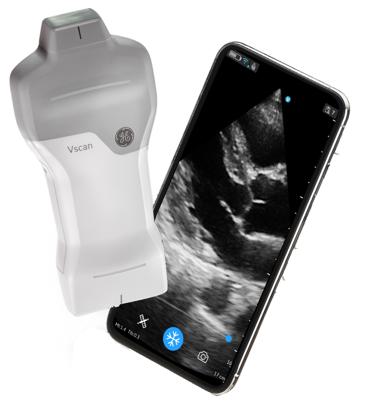 Tiger Scanner GE Vscan Air SL Sector Handheld Ultrasound Scanner. Save at ...