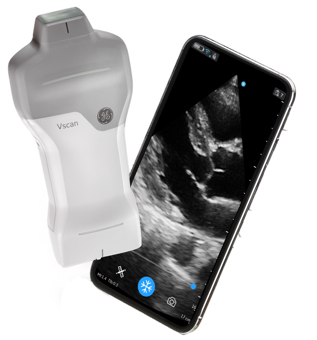 GE Vscan Air SL Sector Handheld Ultrasound Scanner. Save at ...