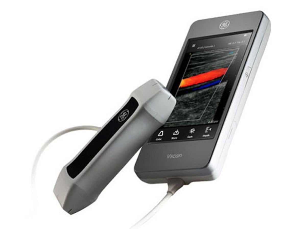GE Extend R2 Handheld Ultrasound Scanner - Save at — Tiger Medical