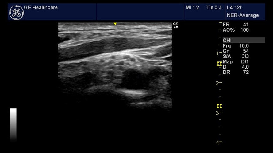 NextGen LOGIQ E R8 Compact Ultrasound w/ 7-Year Clinic Support